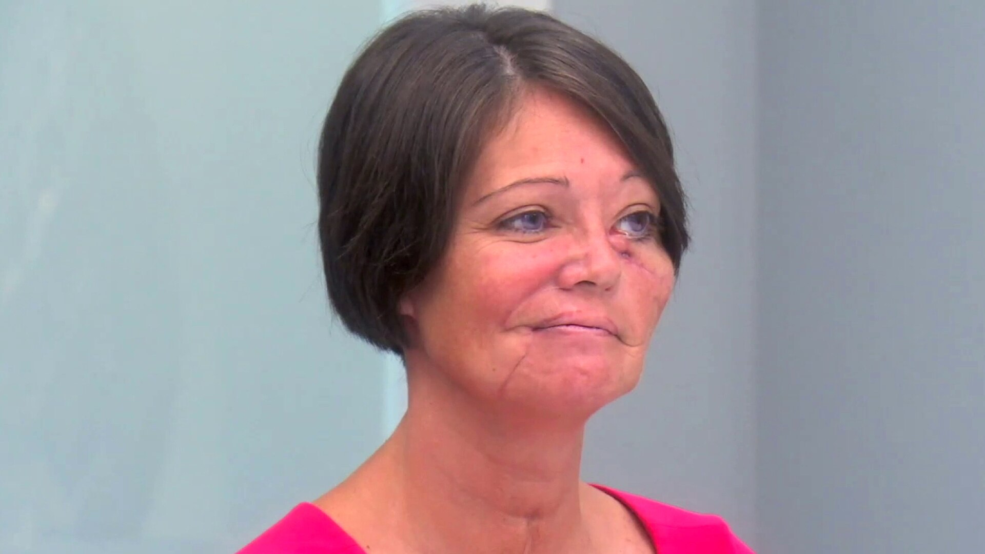 Watch Botched Episode: Hopeful Transformations - NBC.com