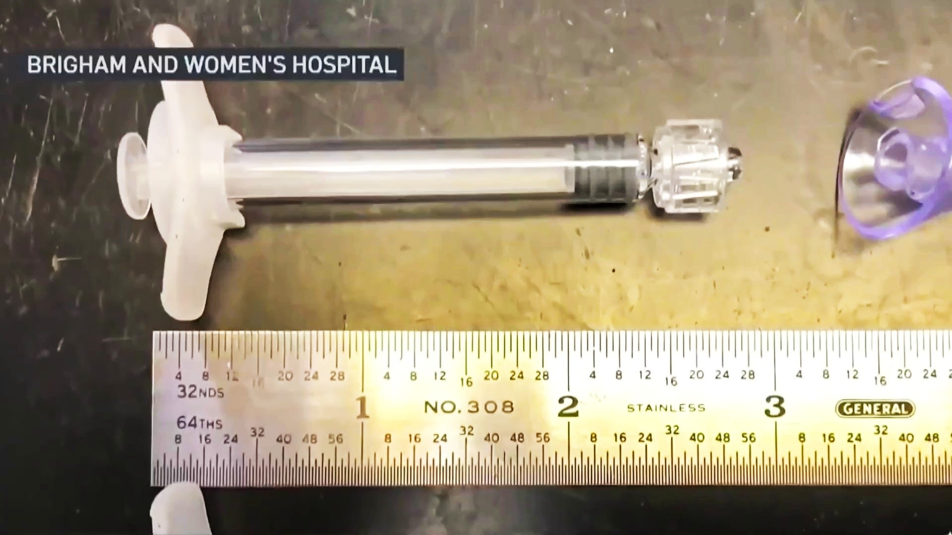 Watch TODAY Excerpt Nasal vaccine for Alzheimer’s enters trial TODAY