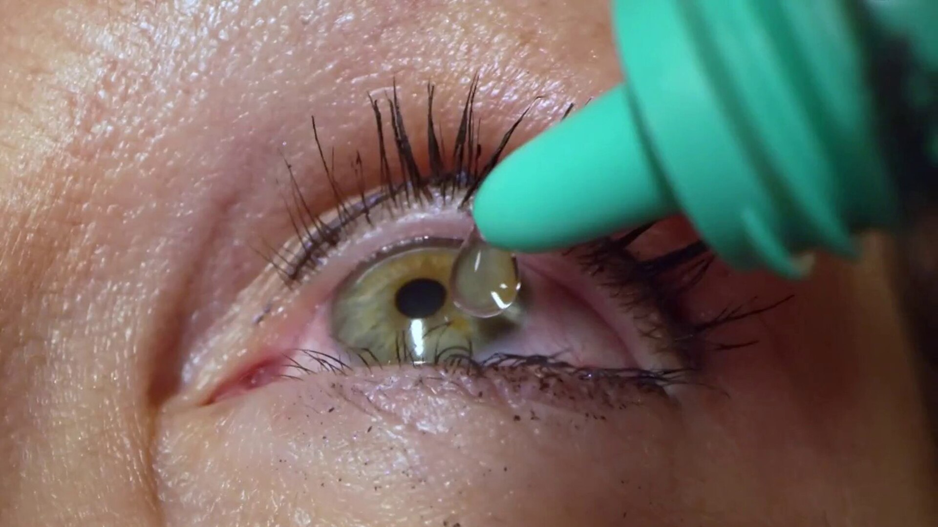 Watch TODAY Excerpt FDAapproved eyedrops could replace your reading