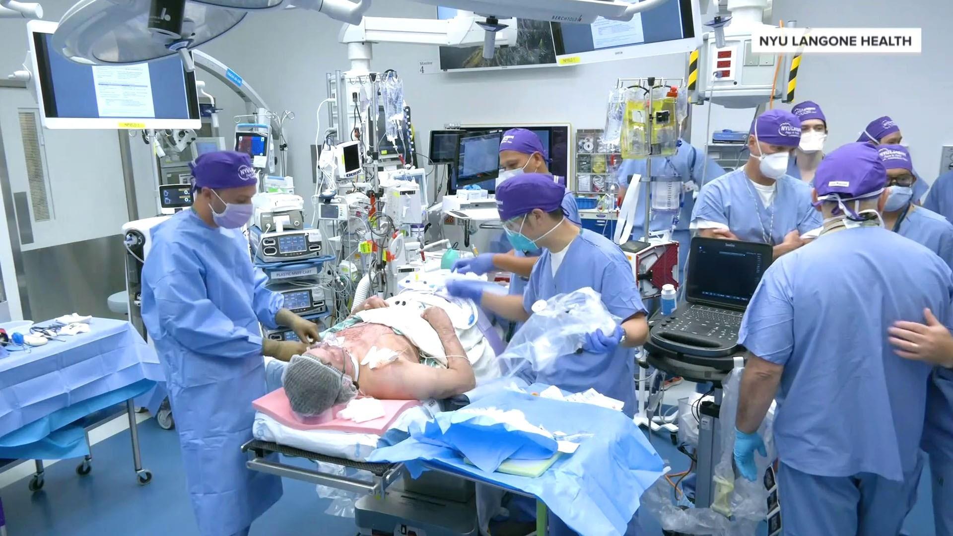 Watch TODAY Highlight First successful double hand transplant and face