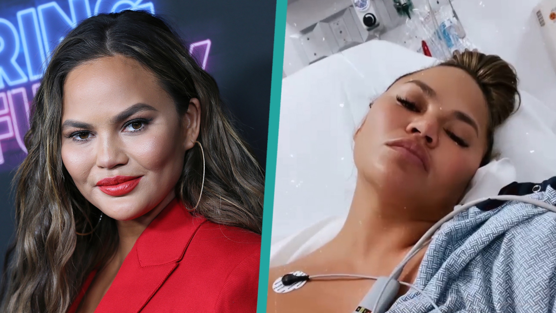 Watch Access Hollywood Interview Chrissy Teigen Reveals She's In The(01)