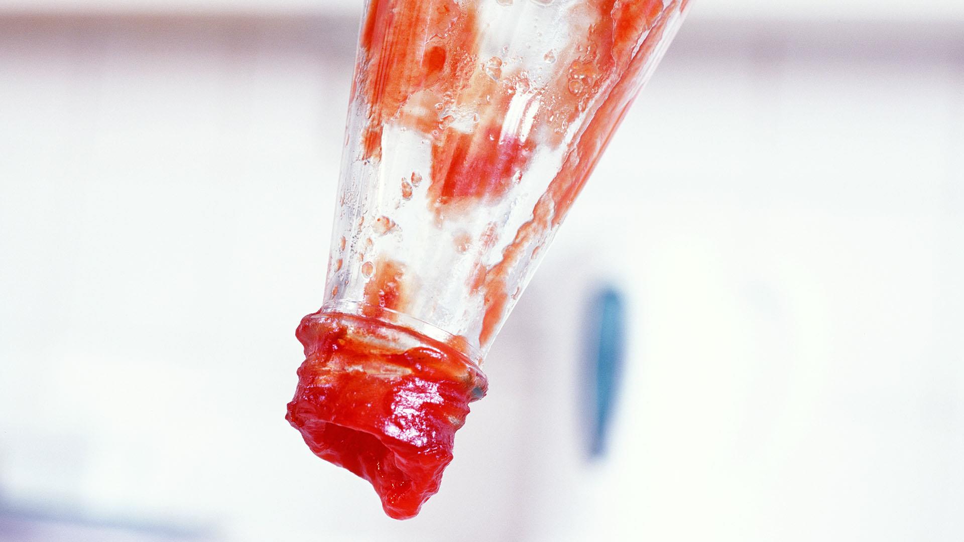 Watch TODAY Highlight What’s behind the ketchup shortage?