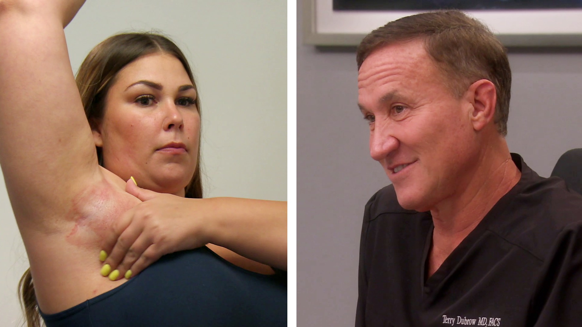 Watch Botched Highlight Botched Returns May 18th
