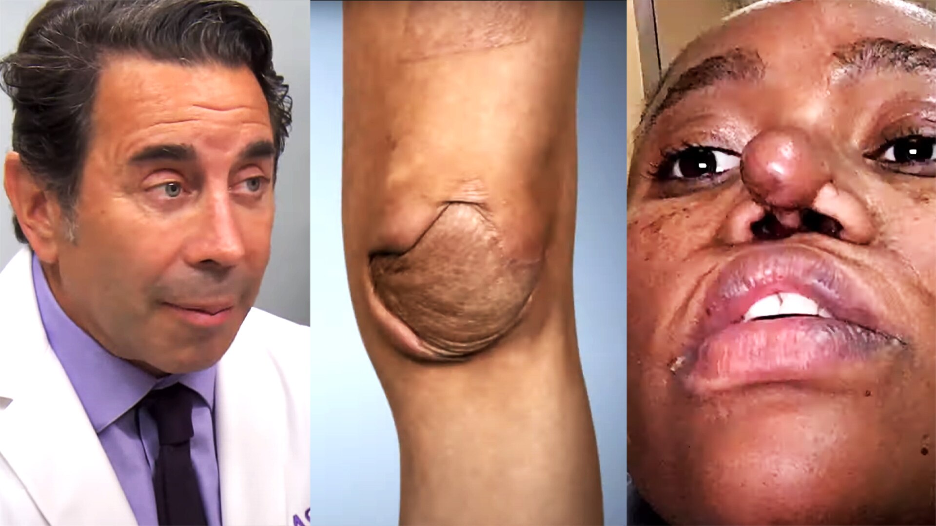 Watch Botched Highlight "Botched" Returns With Weird Knee & Nose Cases