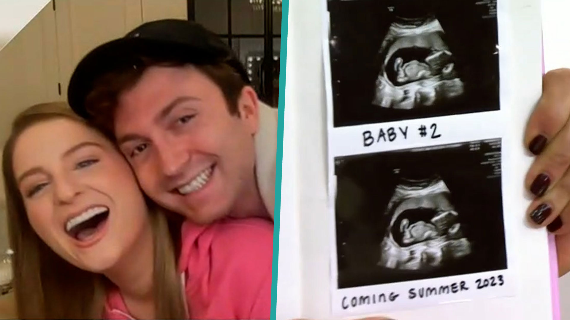 Meghan Trainor & Daryl Sabara Are Expecting Baby No 2, She Announces  Pregnancy Book Too!, books, Celebrity Babies, Daryl Sabara, Expecting, Meghan  Trainor, Pregnant Celebrities